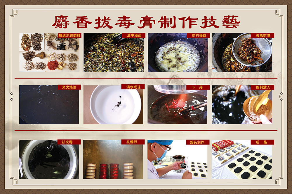 把“非遗名医”请回家：21点五龙游戏网
上门服务，让重度褥疮患者重获新生